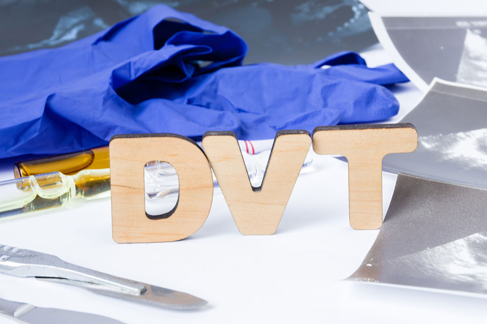 5 Tips That Help Avoid DVT