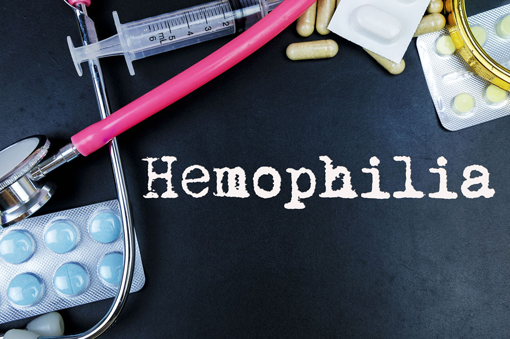 8 Lifestyle Changes to Manage Hemophilia