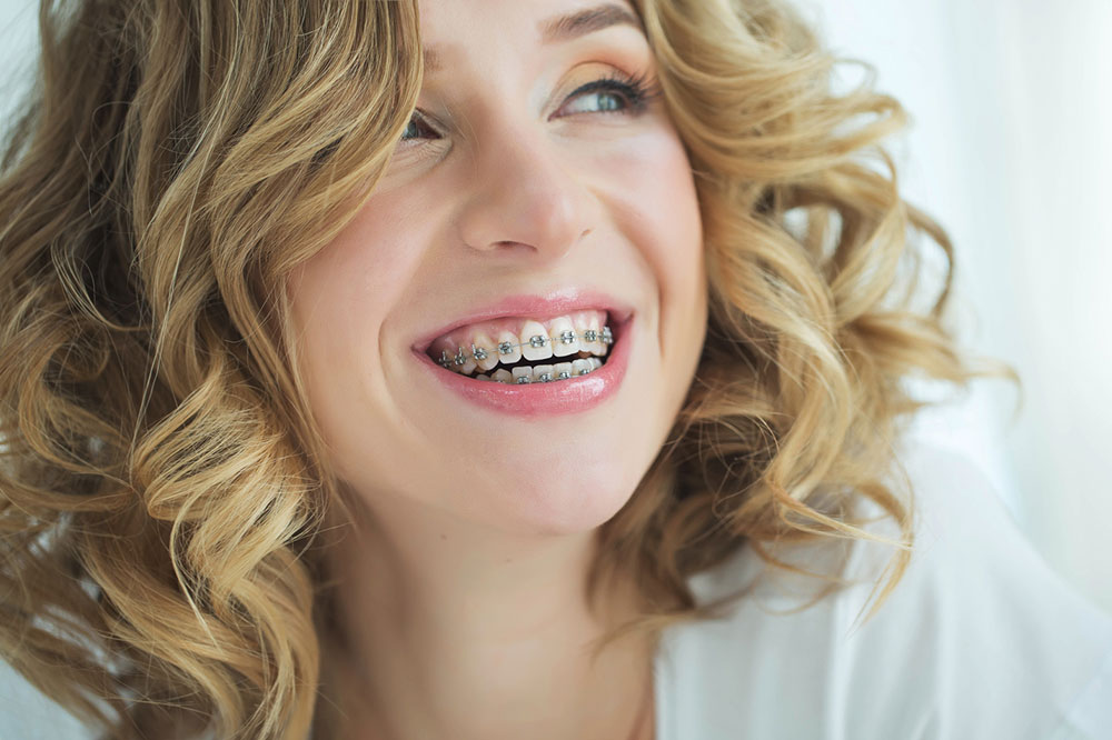 The Advantages of Clear Aligners Vs. Traditional Metal Braces